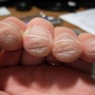 guitarist fingers