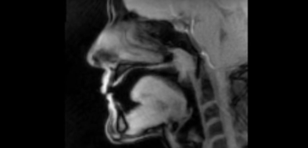 inside horn players mouth